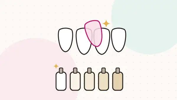 Veneers in Turkey: E-max, Preparation and Natural-Looking Results