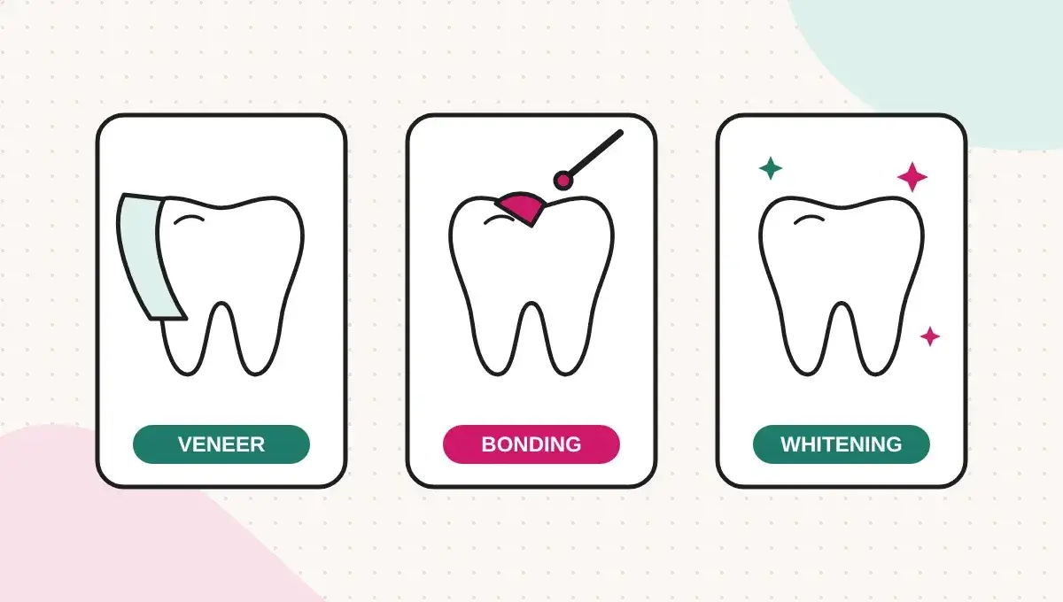 E-max Veneers, Composite Bonding or Whitening: Which Fits the Problem?