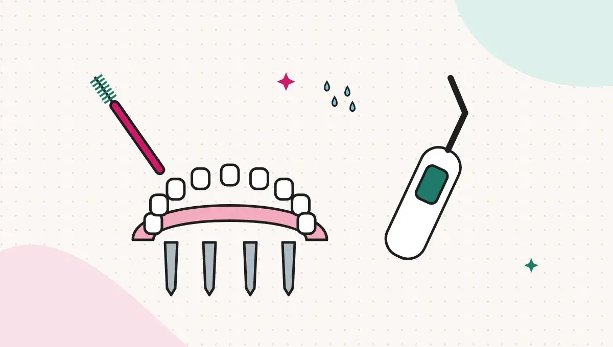 How to Clean an All-on-4 or All-on-6 Bridge